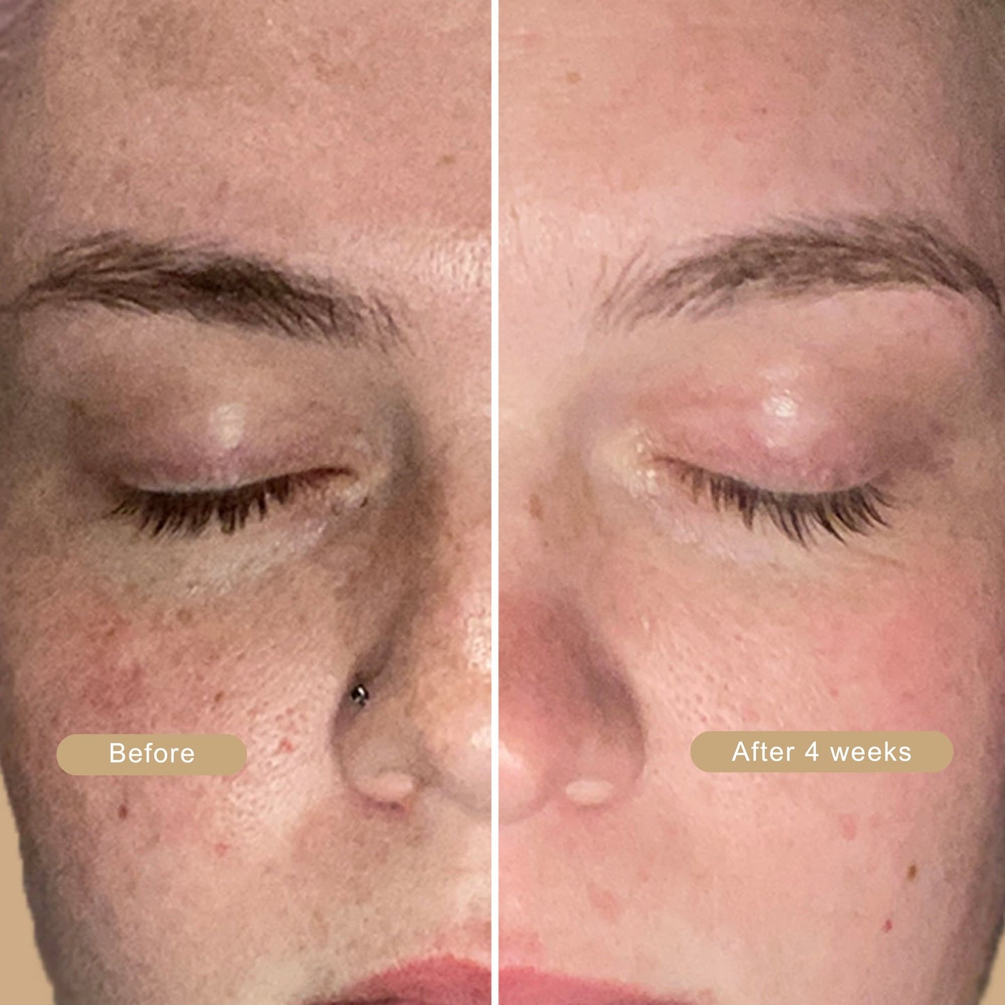 LumiBeauty | Peel Shot