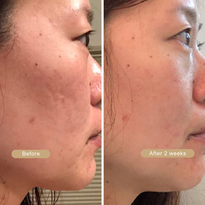 LumiBeauty | Peel Shot