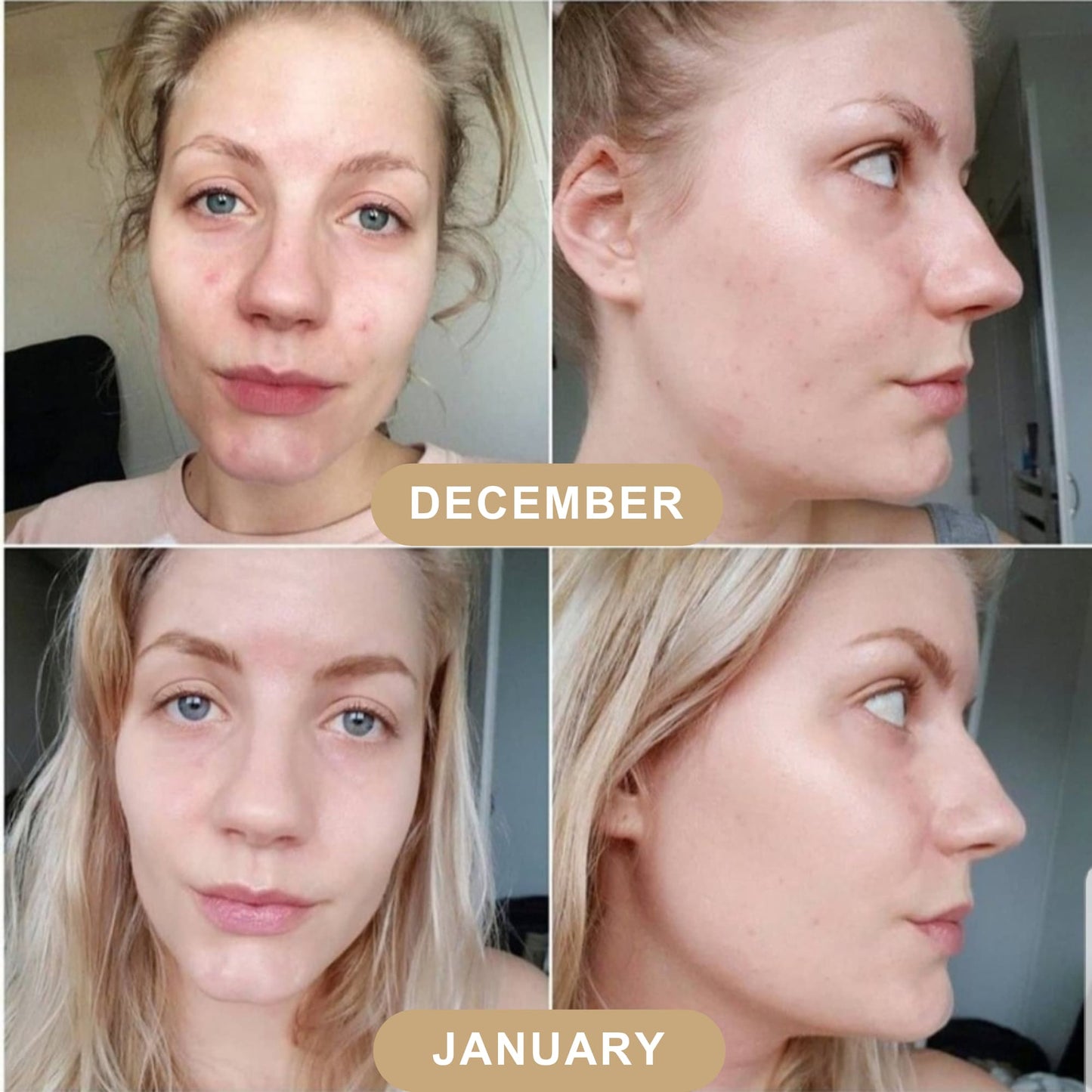 LumiBeauty | Peel Shot