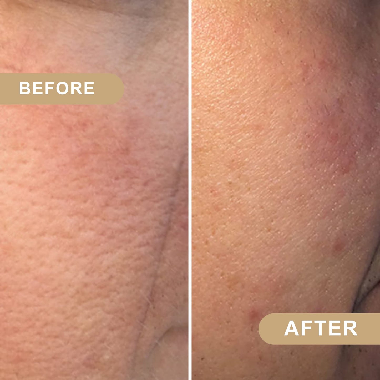 LumiBeauty | Peel Shot