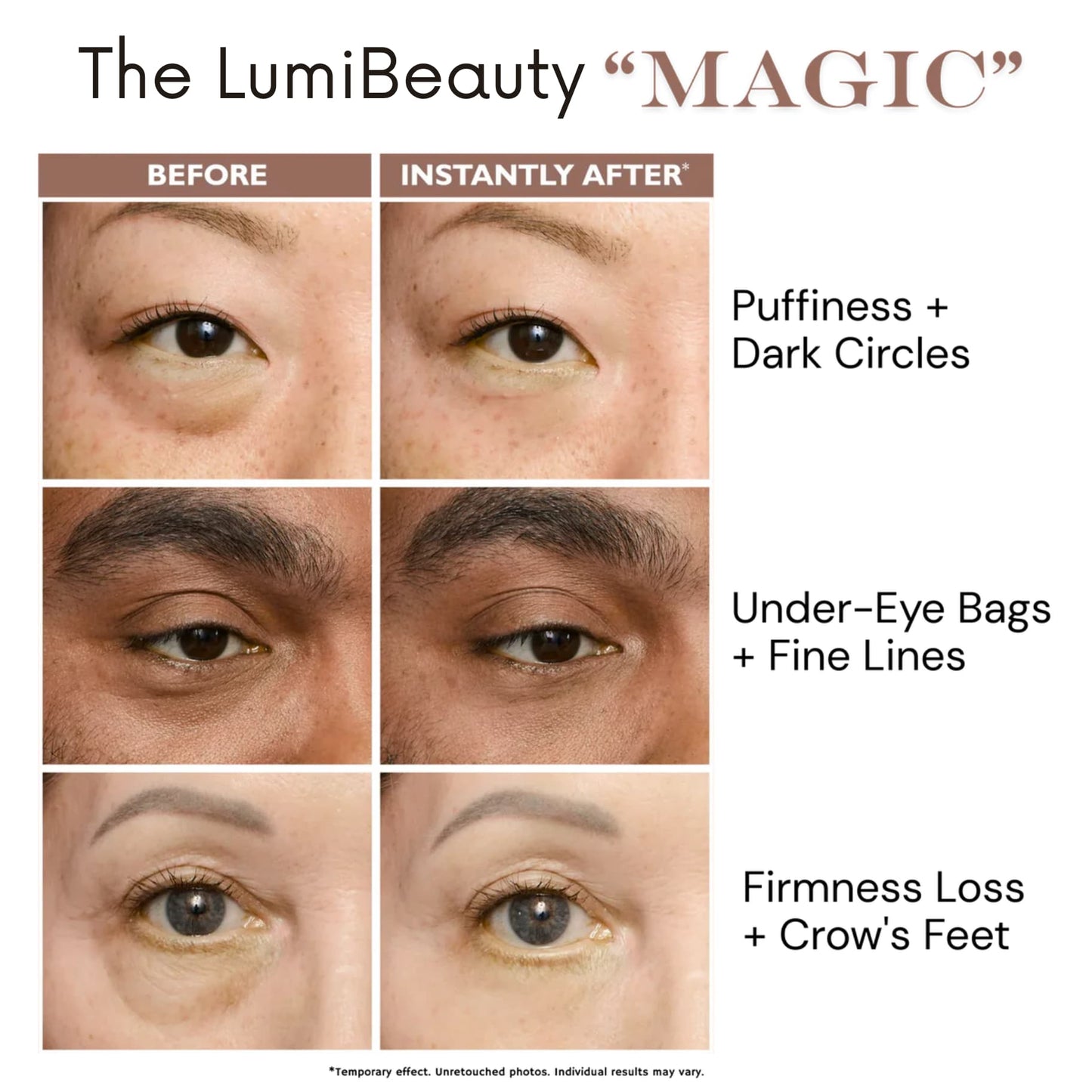 Temporary Eye Tightener