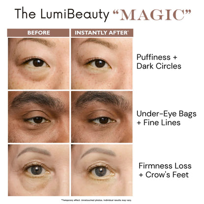 Temporary Eye Tightener