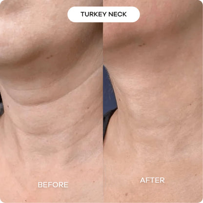 Rejuvenation Filler Serum