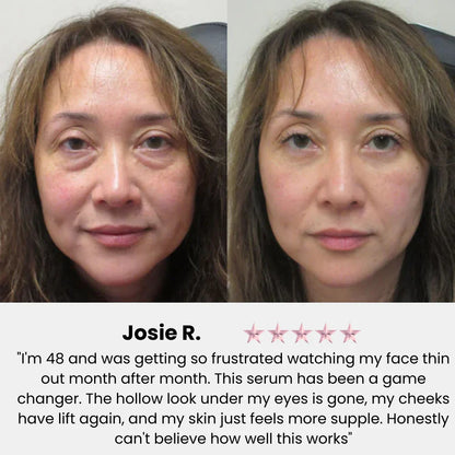 Rejuvenation Filler Serum